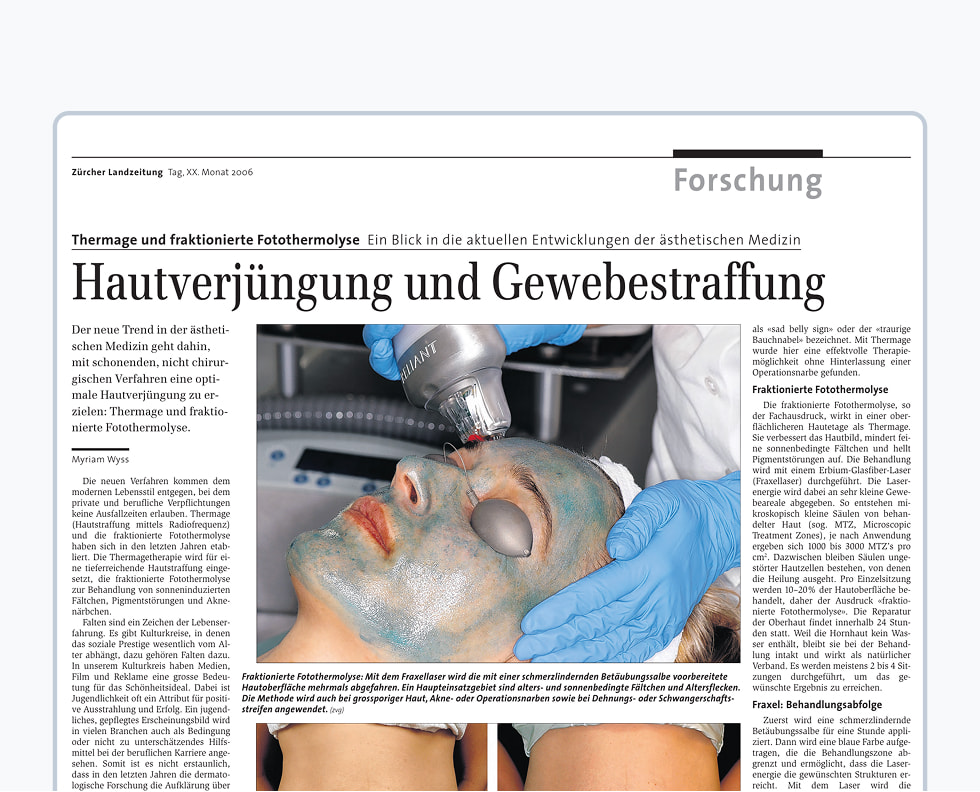 Thermage und fraktionierte Fotothermolyse