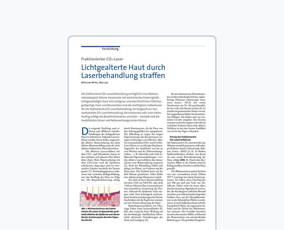Fraktionierter CO2-Laser – Lichtgealterte Haut durch Laserbehandlung straffen