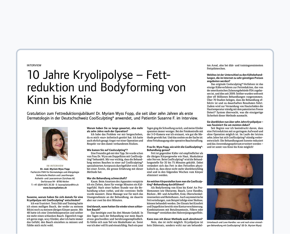 10 Jahre Kryolipolyse – Fettreduktion und Bodyforming von Kinn bis Knie