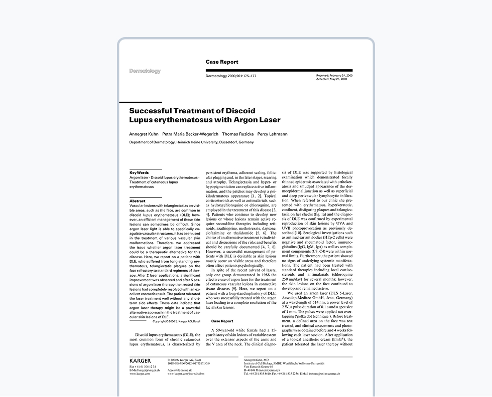 Successful treatment of discoid lupus erythematodes with argon laser