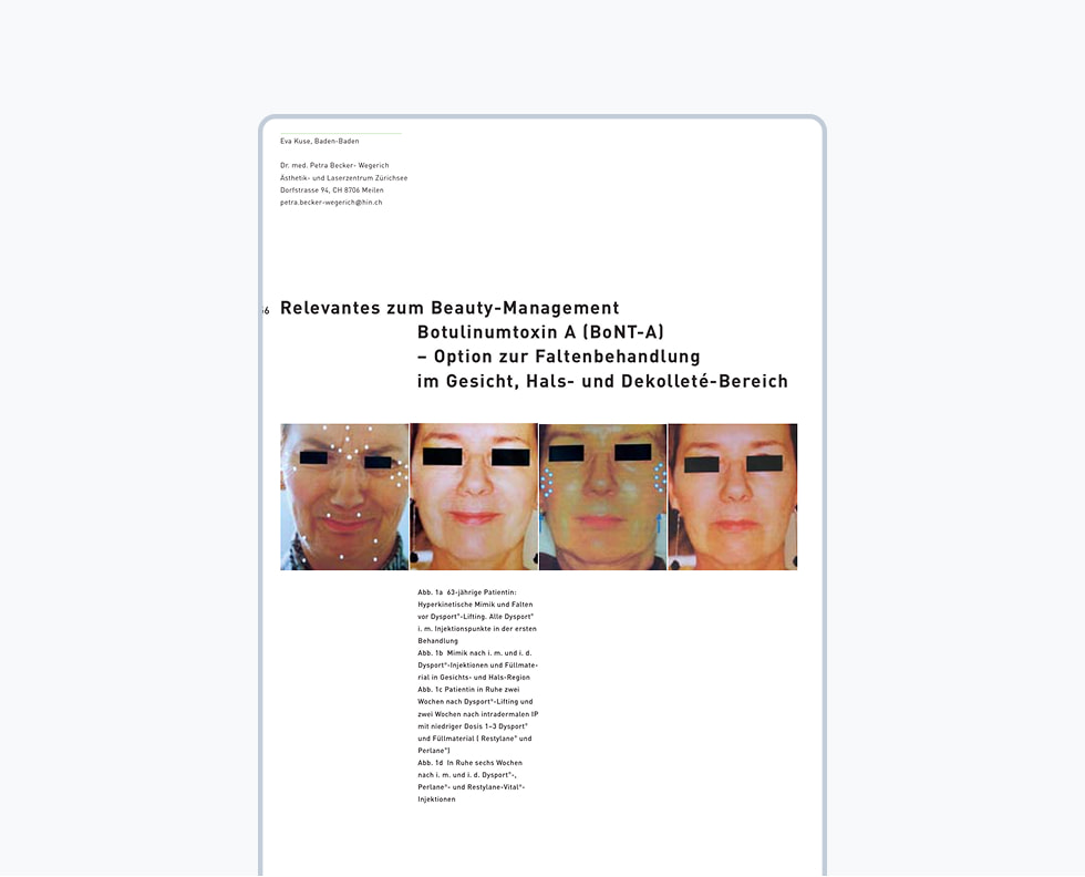 Relevantes zum Beauty-Management Botulinumtoxin A