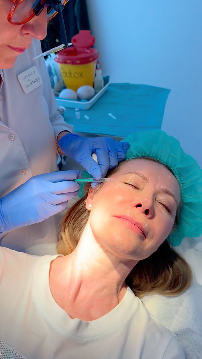 Botox Behandlung