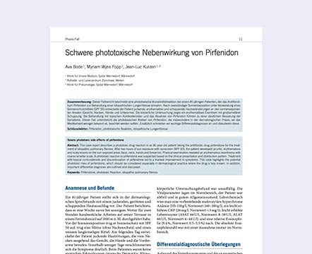 Schwere phototoxische Nebenwirkung von Pirfenidon